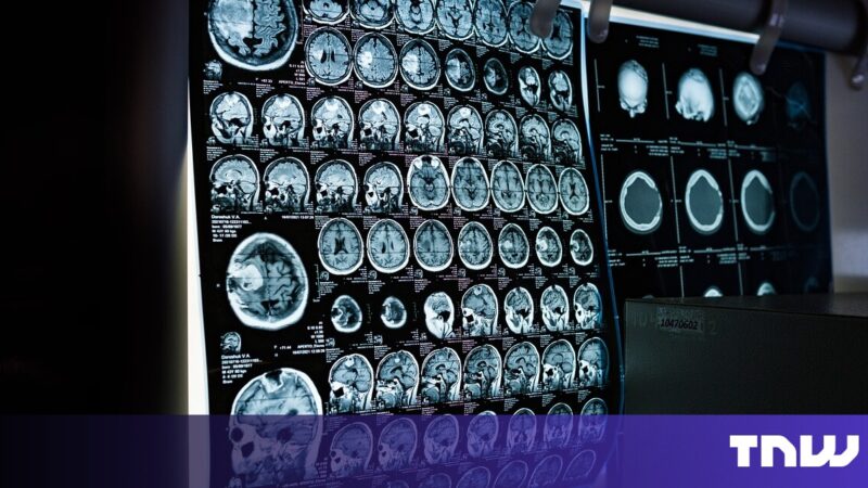 AI nearly twice as good as biopsy at assessing rare cancer